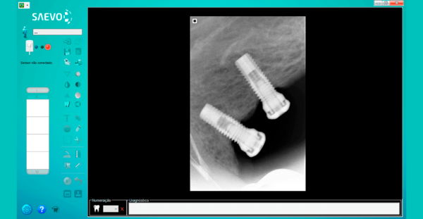 Sensor Intraoral Saevo Slim - Tamanho 1 - Image 4