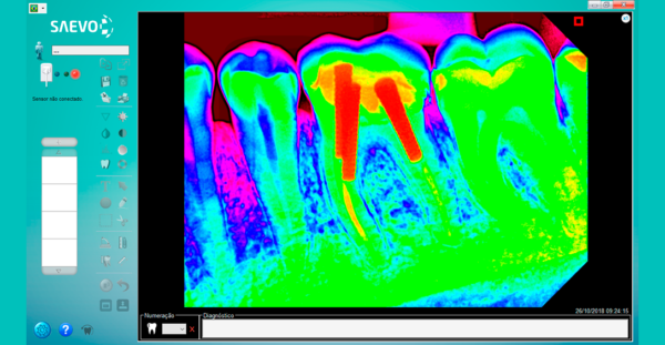 Sensor Intraoral Saevo Slim - Tamanho 2 - Image 6